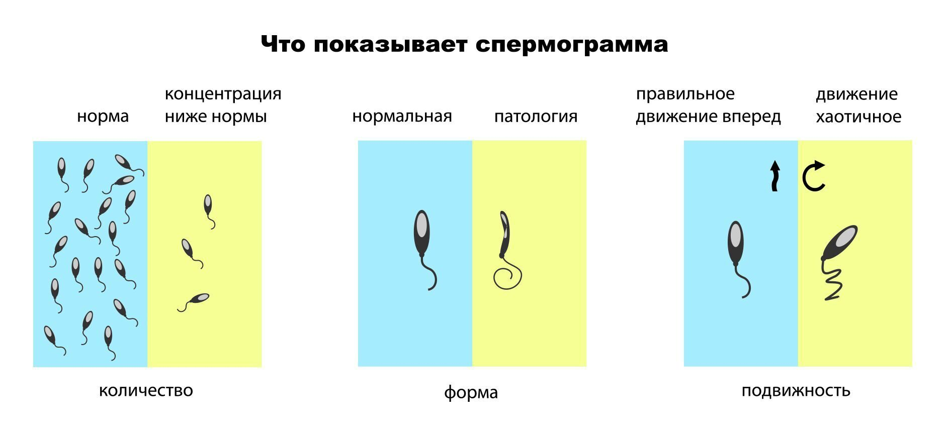 Какой цвет в норме у спермы? - 