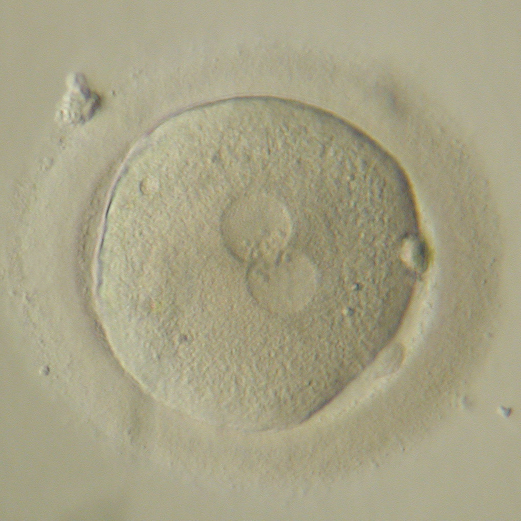 Почему эмбрионы перестают развиваться